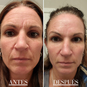 OneDepot™-Parche Antiarrugas Gel Colágeno