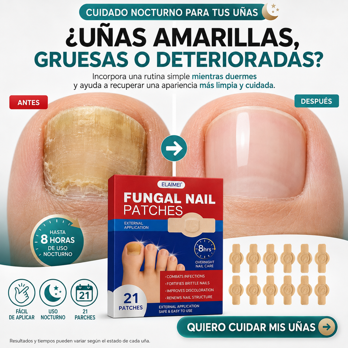 Parches Antihongos para Uñas