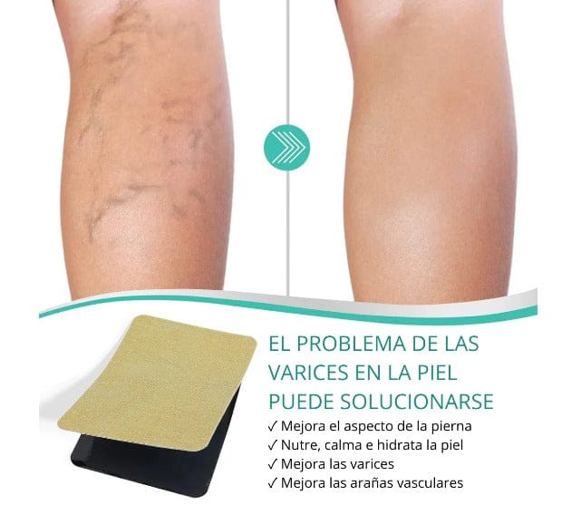 VarixRelief™-Parches Naturales para Varices